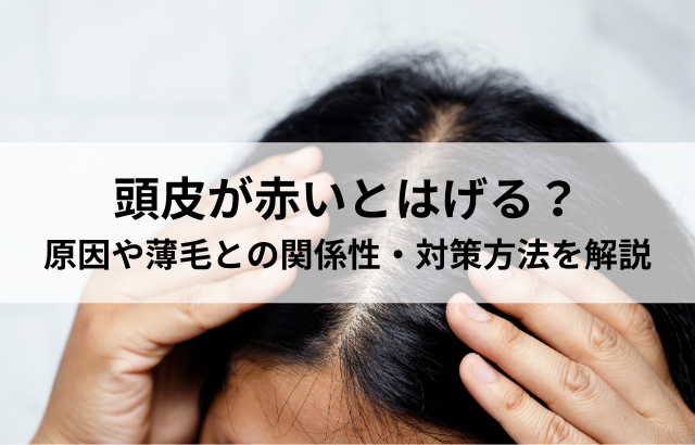 頭皮が赤いとはげる？原因や薄毛との関係性・対策方法を解説