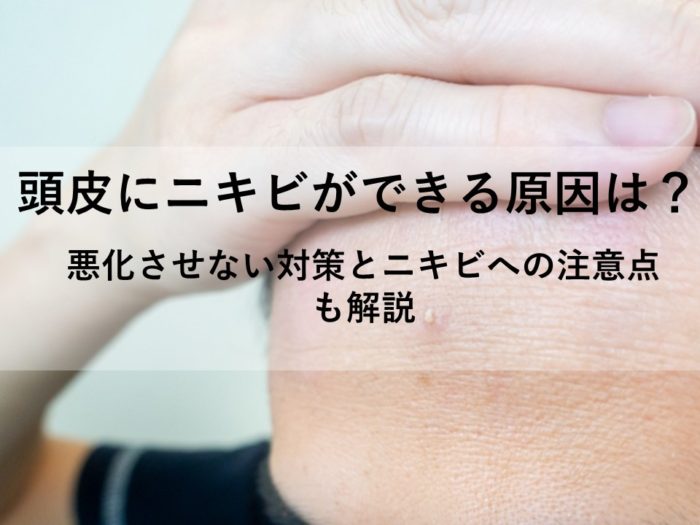 頭皮ニキビの症状