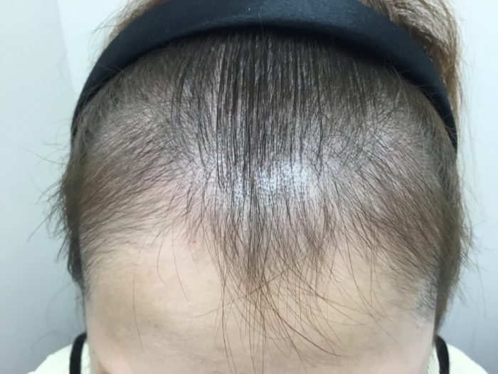 皮膚科医の診察を受ける時期