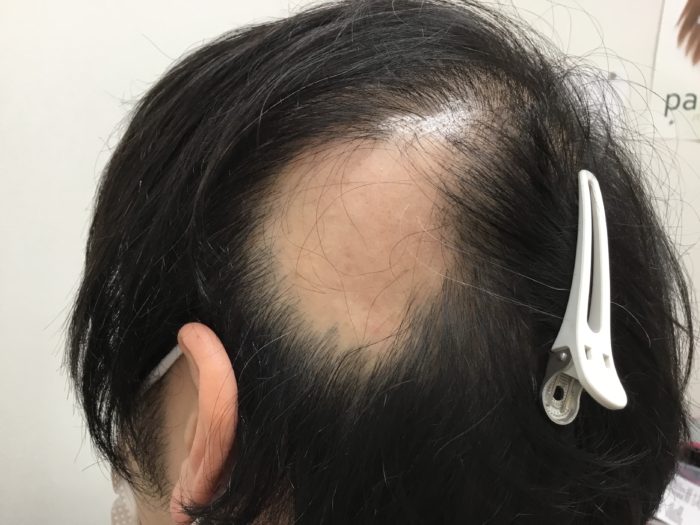 食事は症状の改善に役立ちますか?